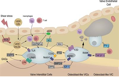 Advances in Pathophysiology of Calcific Aortic Valve Disease Propose Novel Molecular Therapeutic Targets